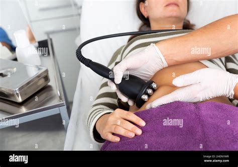 fat cavitation parramatta|Ultrasonic Fat Cavitation .